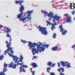 Gramstain 1